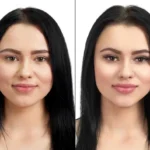 kris jenner before and after face lift