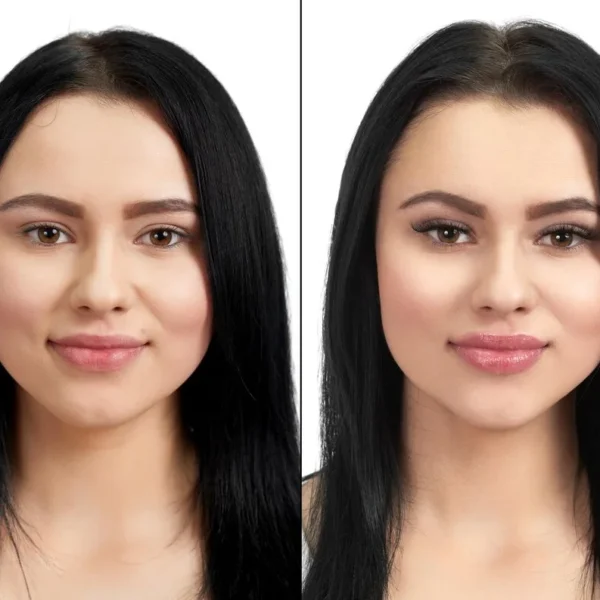 kris jenner before and after face lift