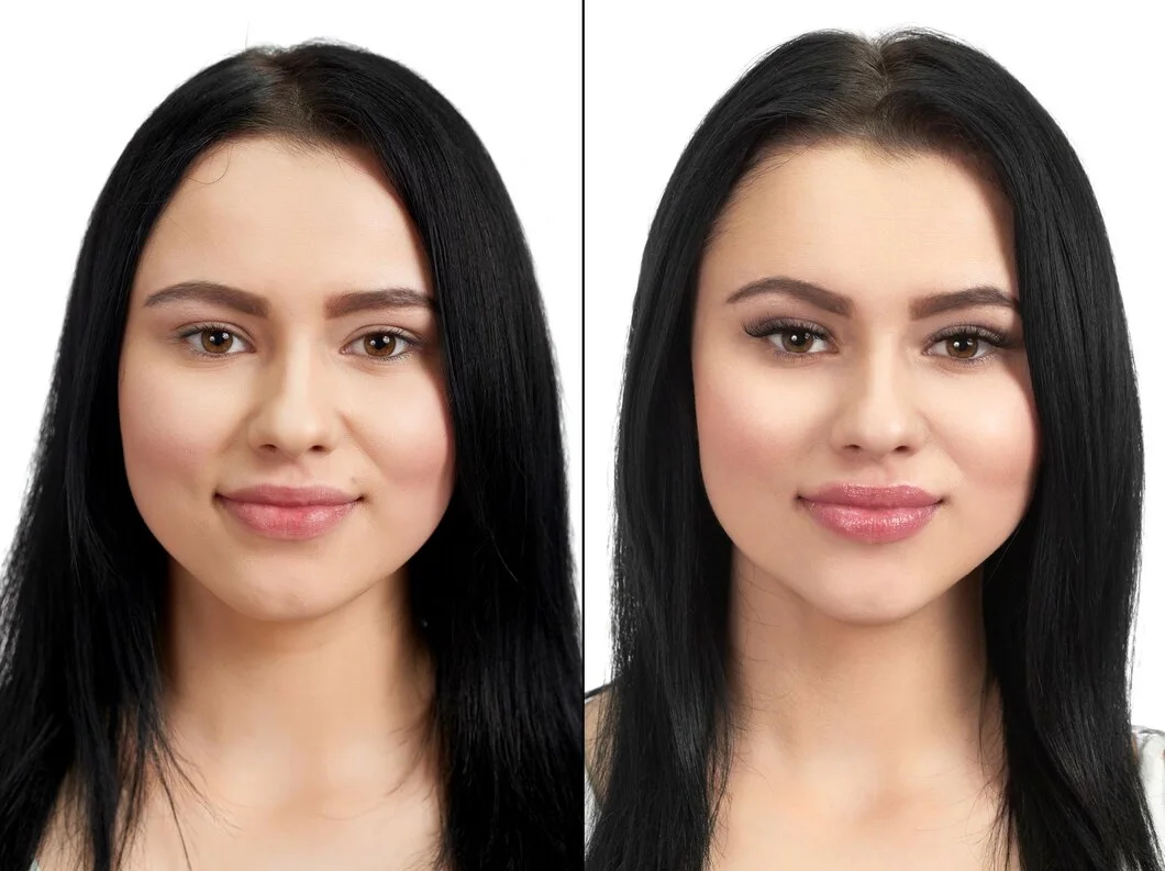 kris jenner before and after face lift